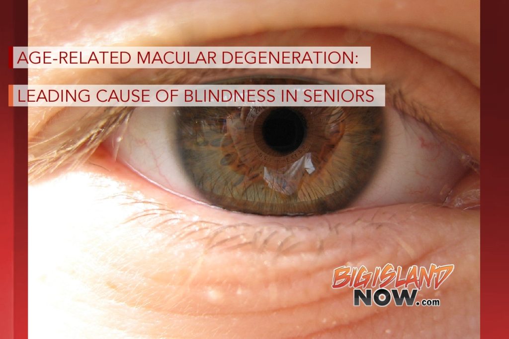 AgeRelated Macular Degeneration Leading Cause of Blindness in Seniors
